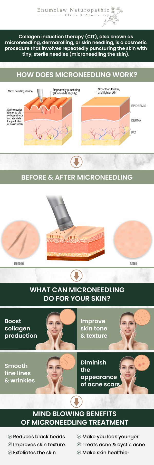 Common questions asked by clients: What is PRP Microneedling? What skin concerns can PRP Microneedling address? Is PRP Microneedling safe? How long does a PRP Microneedling session last? Can Dr. Natalie Walch at Enumclaw Naturopathic Clinic help with PRP Microneedling? For more information, contact us or request an appointment online. We are located at 2355 Griffin Ave Ste S, Enumclaw, WA 98022. Common questions asked by clients: What is PRP Microneedling? What skin concerns can PRP Microneedling address? Is PRP Microneedling safe? How long does a PRP Microneedling session last? Can Dr. Natalie Walch at Enumclaw Naturopathic Clinic help with PRP Microneedling? For more information, contact us or request an appointment online. We are located at 2355 Griffin Ave Ste S, Enumclaw, WA 98022.