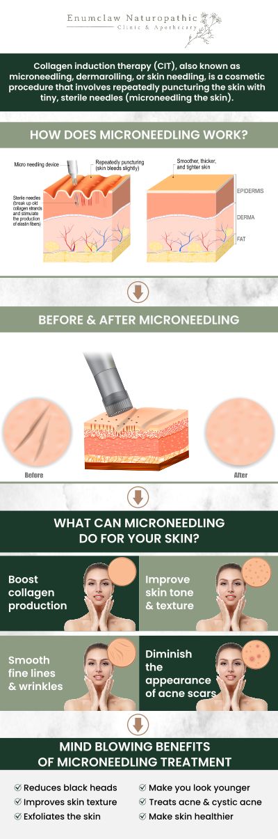 Common questions asked by clients: What is PRP Microneedling? What skin concerns can PRP Microneedling address? Is PRP Microneedling safe? How long does a PRP Microneedling session last? Can Dr. Natalie Walch at Enumclaw Naturopathic Clinic help with PRP Microneedling? For more information, contact us or request an appointment online. We are located at 2355 Griffin Ave Ste S, Enumclaw, WA 98022. Common questions asked by clients: What is PRP Microneedling? What skin concerns can PRP Microneedling address? Is PRP Microneedling safe? How long does a PRP Microneedling session last? Can Dr. Natalie Walch at Enumclaw Naturopathic Clinic help with PRP Microneedling? For more information, contact us or request an appointment online. We are located at 2355 Griffin Ave Ste S, Enumclaw, WA 98022.